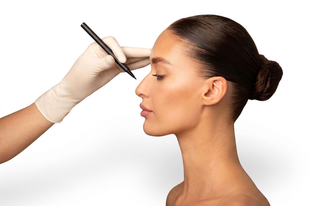 Rinoplastia